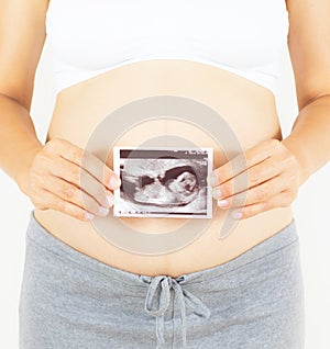 Pregnant woman holding the digital echography photograph of her photo