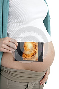 Pregnant woman holding scan