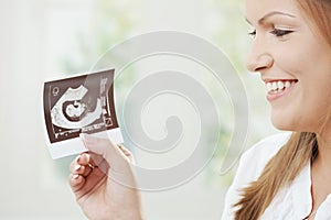 Pregnant woman holding sonogram photo