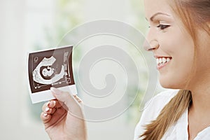 Pregnant woman holding sonogram photo