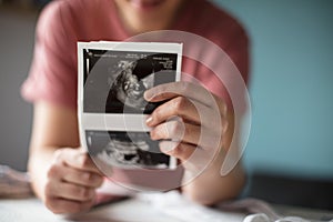 Pregnant woman holding a sonogram of her unborn baby