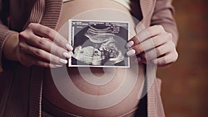 Pregnant woman holding sonography photo near her big belly, tracking shot, slow motion