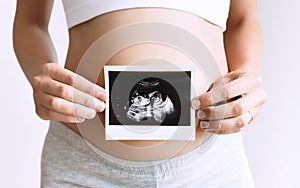 Pregnant woman holding ultrasound baby image