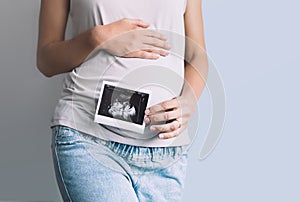 Pregnant woman holding ultrasound baby image