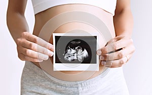 Pregnant woman holding ultrasound baby image photo