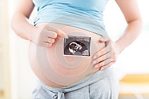 Pregnant woman holding ultrasound scan