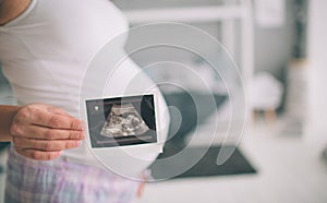 Pregnant woman holding ultrasound scan. Concept of Pregnancy health care