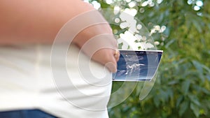 Pregnant woman holding ultrasound scan, photo or picture on the belly of her future daughter or son in the arms. Girl