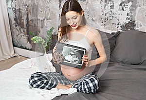 A pregnant woman holds a baby`s scan