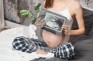 A pregnant woman holds a baby`s sonogram