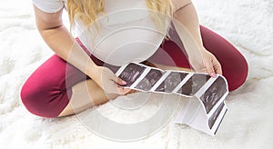 A pregnant woman holds a snapshot of an ultrasound in her hands. Selective Focus