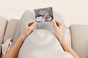 Pregnant woman looking at her baby sonography