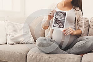 Pregnant woman looking at her baby sonography