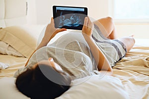 Pregnant Woman Looking at Medical Baby Scan on Tablet