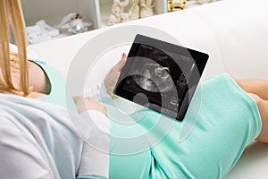 Pregnant woman looking at ultrasonography of her baby