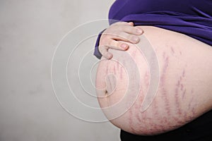 Pregnant woman with natural stomach