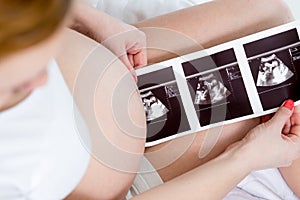 Pregnant woman reviewing baby ultrasound scan