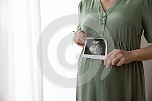 Pregnant woman showing unborn baby sonogram image at camera