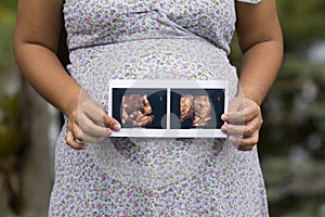 Pregnant woman touching her big belly photo