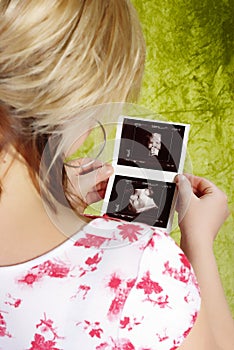 Pregnant woman with a ultrasound image