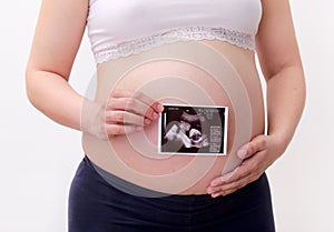 Pregnant woman with ultrasound photography