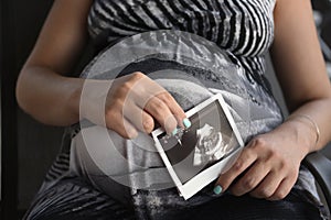 Pregnant woman ultrasound scan