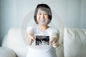 Pregnant woman with ultrasound scan picture