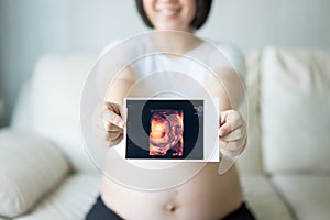 Pregnant woman with ultrasound scan picture