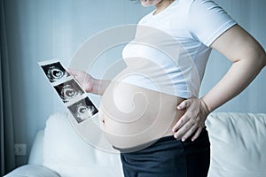 Pregnant woman with ultrasound scan picture