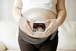 Pregnant woman with ultrasound scan picture