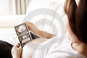 Pregnant woman with ultrasound scan picture