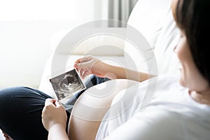 Pregnant woman with ultrasound scan picture