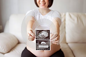 Pregnant woman with ultrasound scan picture