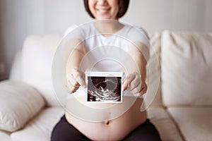 Pregnant woman with ultrasound scan picture