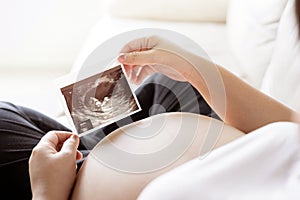 Pregnant woman with ultrasound scan picture