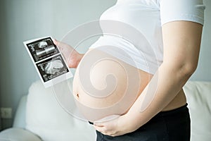 Pregnant woman with ultrasound scan picture