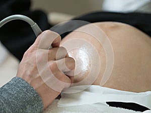 Pregnant woman undergoing ultrasound scan in clinic, closeup