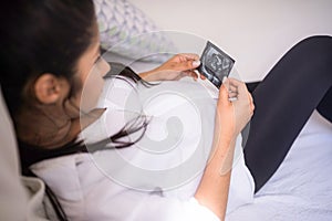 Pregnant woman watching her son`s ultrasound