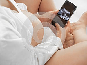 A pregnant woman in white clothes with a bare big belly sits in a white room and looks at an ultrasound scan of her
