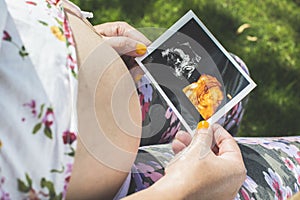 Pregnant women hold picture of womb