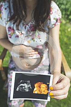 Pregnant women hold picture of womb