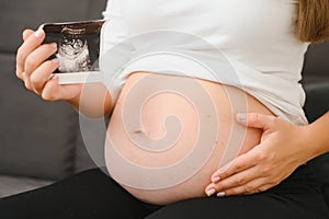 Pregnant women holding echo pictures in hand