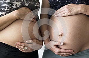 Pregnant women showing their bumps