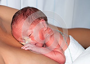 Premature baby img