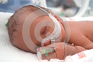 Premature Baby img