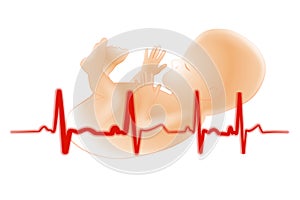 Premature Baby Fetus Electrocardiogram photo