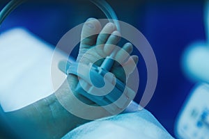 Premature baby foot under ultraviolet lamp