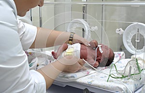 Premature baby in intensive care unit at hospital