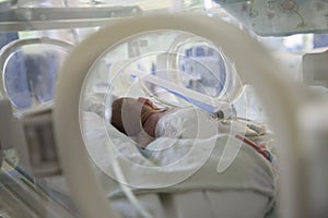 Neonatal Intensive Care