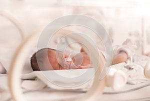 Premature newborn baby girl